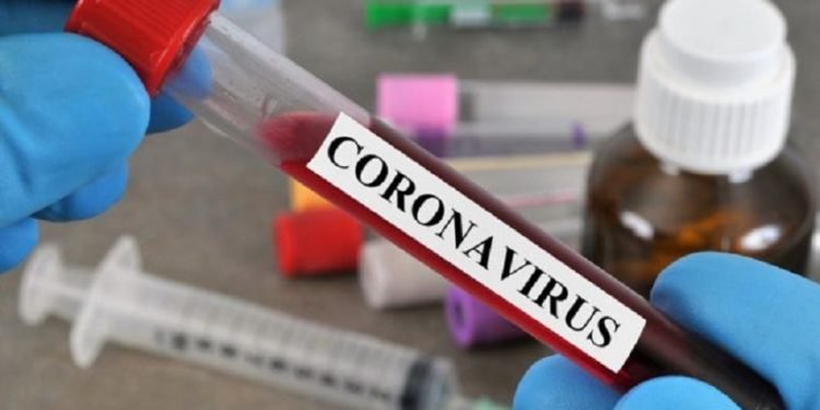 Coronavirus Update – ‘Major Breakthrough’ in Covid-19 Treatment; 490 new cases recorded in Nigeria