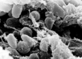 Bubonic Plague reported in China – officials issue Health Alert