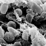 Bubonic Plague reported in China - officials issue Health Alert