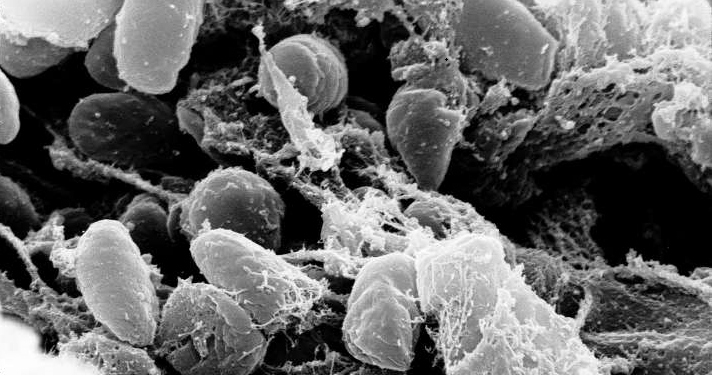 Bubonic Plague reported in China – officials issue Health Alert