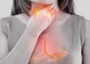 HEARTBURNS: Complications, causes, and control