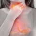 HEARTBURNS: Complications, causes, and control