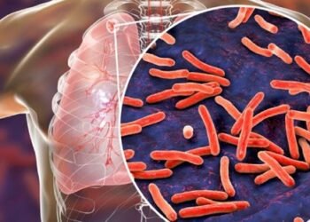 Tuberculosis: New biomarker indicates individual treatment duration.