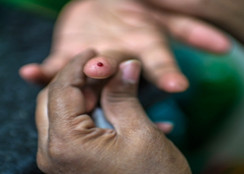 DIABETIC: Diabetes vaccine gives promising results in genetic subgroup