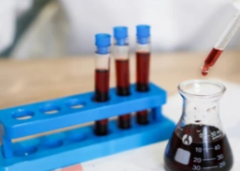 New blood test improves prostate cancer screening