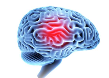 Young athletes with history of concussions may have more changes to their brains