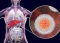 WHO has prequalified the first hepatitis C virus self-test kit