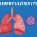 Tuberculosis resurges, causing 1.25million deaths in 2023 – WHO