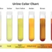 What does your urine say about your health – Health corner